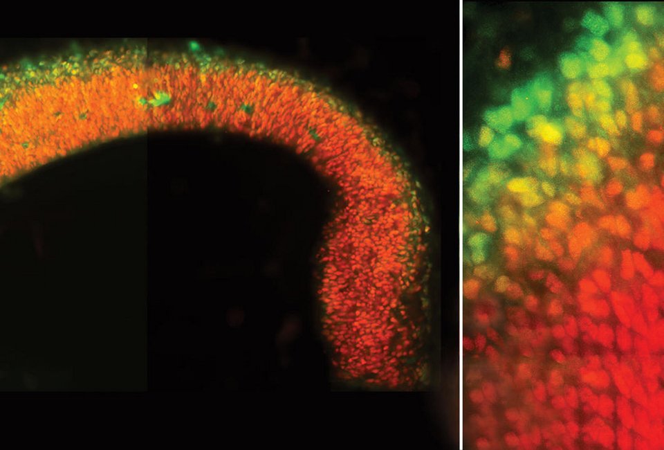 Ο άνθρωπος που χρωμάτισε τον εγκέφαλο και αποκάλυψε άγνωστες συνδέσεις και λειτουργίες του [εικόνες] | iefimerida.gr 2