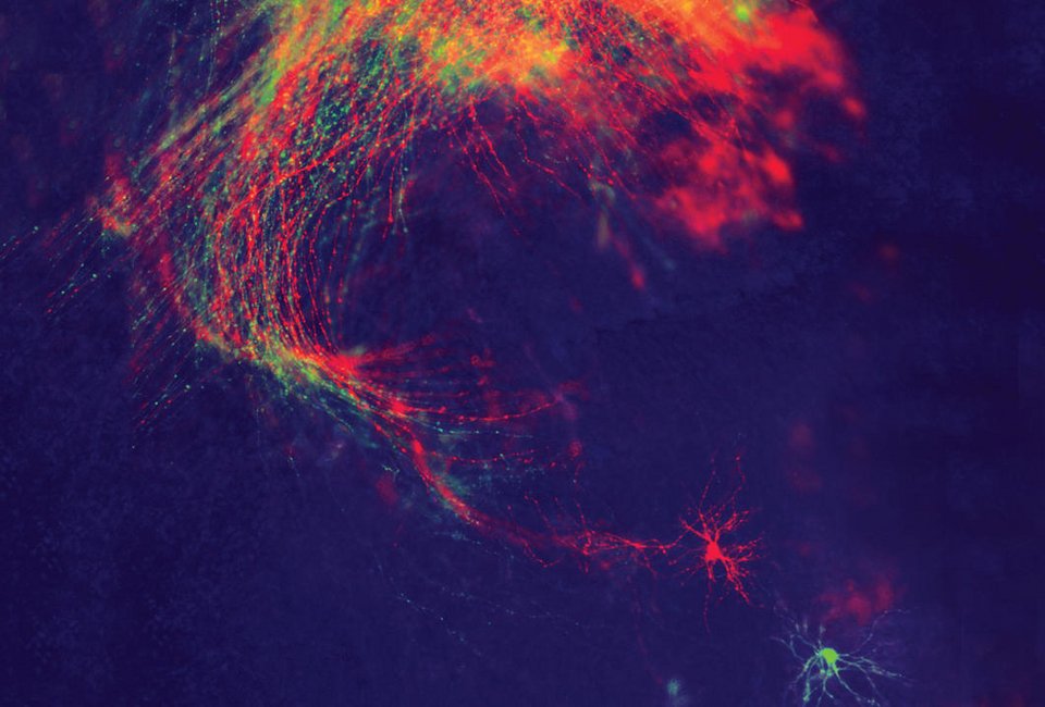 Ο άνθρωπος που χρωμάτισε τον εγκέφαλο και αποκάλυψε άγνωστες συνδέσεις και λειτουργίες του [εικόνες] | iefimerida.gr 0