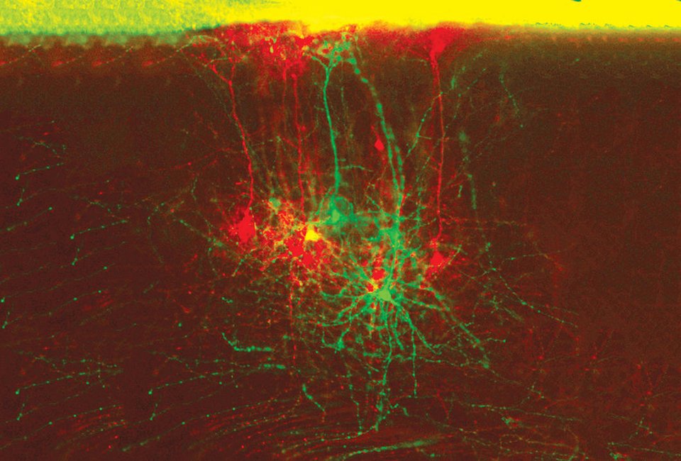 Ο άνθρωπος που χρωμάτισε τον εγκέφαλο και αποκάλυψε άγνωστες συνδέσεις και λειτουργίες του [εικόνες] | iefimerida.gr 1