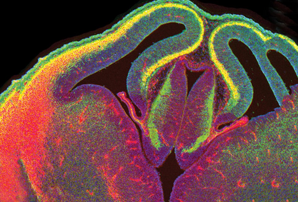 Ο άνθρωπος που χρωμάτισε τον εγκέφαλο και αποκάλυψε άγνωστες συνδέσεις και λειτουργίες του [εικόνες] | iefimerida.gr 3