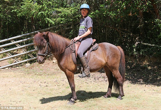 Γυναίκα με μισό σαγόνι δηλώνει περήφανη για την εμφάνιση της και μιλάει για τη ζωή της [εικόνες] | iefimerida.gr 4
