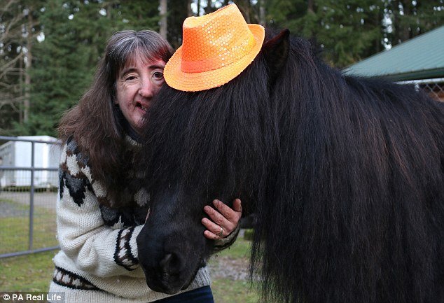 Γυναίκα με μισό σαγόνι δηλώνει περήφανη για την εμφάνιση της και μιλάει για τη ζωή της [εικόνες] | iefimerida.gr 3