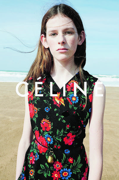 Πεταχτά αυτιά, ο κρυφός εφιάλτης [εικόνες] | iefimerida.gr 0