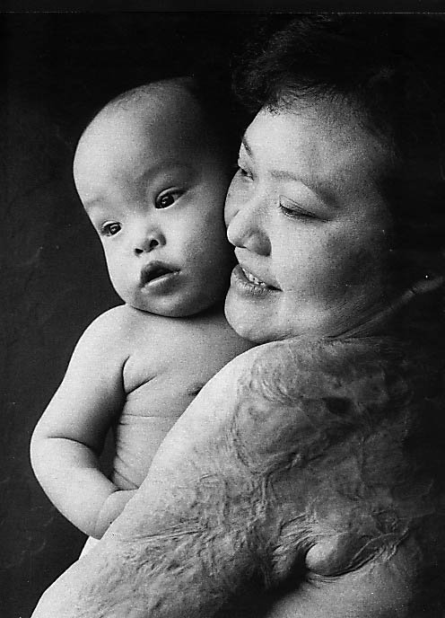 Το κορίτσι που κάηκε από ναπάλμ στο Βιετνάμ, σήμερα [εικόνες] | iefimerida.gr 5