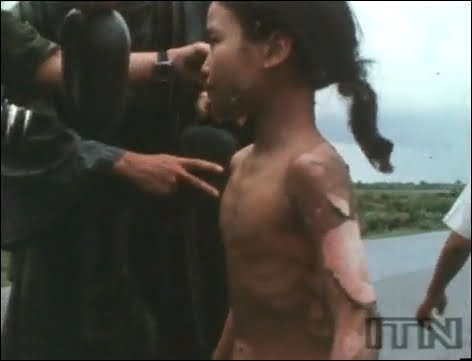 Το κορίτσι που κάηκε από ναπάλμ στο Βιετνάμ, σήμερα [εικόνες] | iefimerida.gr 3