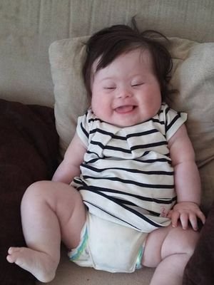 Σας παρακαλώ, μη με ρωτάτε γιατί το παιδί μου έχει σύνδρομο Down [εικόνες] | iefimerida.gr 4