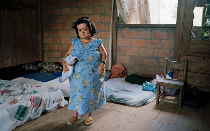 Οι νάνοι των Ανδεων: Πάσχουν από μια σπάνια νόσο, αλλά έχουν ανοσία σε καρκίνο και διαβήτη [εικόνες] | iefimerida.gr 5