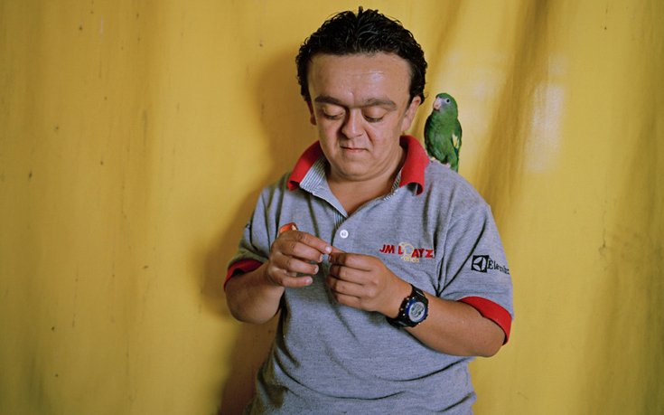 Οι νάνοι των Ανδεων: Πάσχουν από μια σπάνια νόσο, αλλά έχουν ανοσία σε καρκίνο και διαβήτη [εικόνες] | iefimerida.gr 7