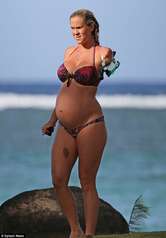 Της έφαγε το χέρι καρχαρίας αλλά δεν το έβαλε κάτω -Η εγκυμοσύνη, το παιδί [εικόνες] | iefimerida.gr 3