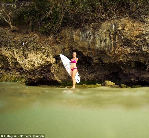 Της έφαγε το χέρι καρχαρίας αλλά δεν το έβαλε κάτω -Η εγκυμοσύνη, το παιδί [εικόνες] | iefimerida.gr 7