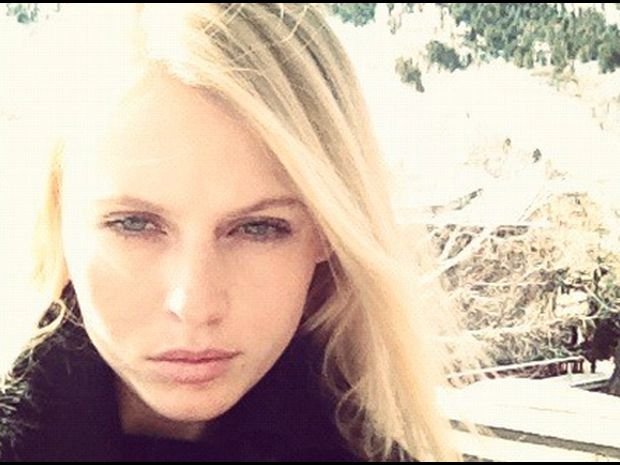 Απίστευτο: Μοντέλο έχασε το πόδι του από ένα ταμπόν [εικόνες] | iefimerida.gr 1