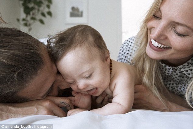 Μπόμπιρας με Σύνδρομο Down κάνει καριέρα στο μόντελινγκ [εικόνες & βίντεο]  | iefimerida.gr 1