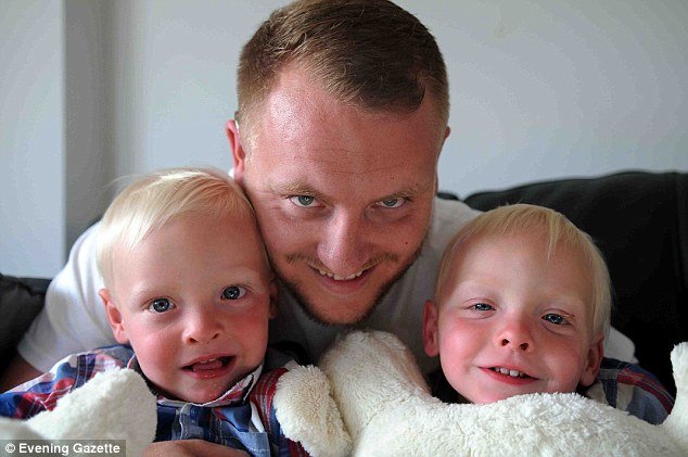 Δίδυμα ολόιδια αλλά με μια ιδιαιτερότητα: Το ένα έχει τα οργανά του σε λάθος πλευρά [εικόνες]  | iefimerida.gr 1