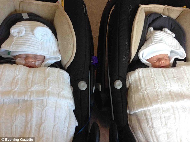 Δίδυμα ολόιδια αλλά με μια ιδιαιτερότητα: Το ένα έχει τα οργανά του σε λάθος πλευρά [εικόνες]  | iefimerida.gr 2