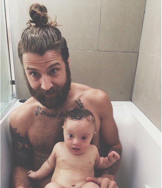 Μπόμπιρας με Σύνδρομο Down κάνει καριέρα στο μόντελινγκ [εικόνες & βίντεο]  | iefimerida.gr 2