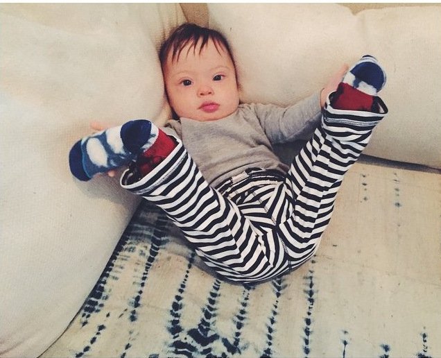 Μπόμπιρας με Σύνδρομο Down κάνει καριέρα στο μόντελινγκ [εικόνες & βίντεο]  | iefimerida.gr 0