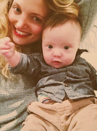 Μπόμπιρας με Σύνδρομο Down κάνει καριέρα στο μόντελινγκ [εικόνες & βίντεο]  | iefimerida.gr 3