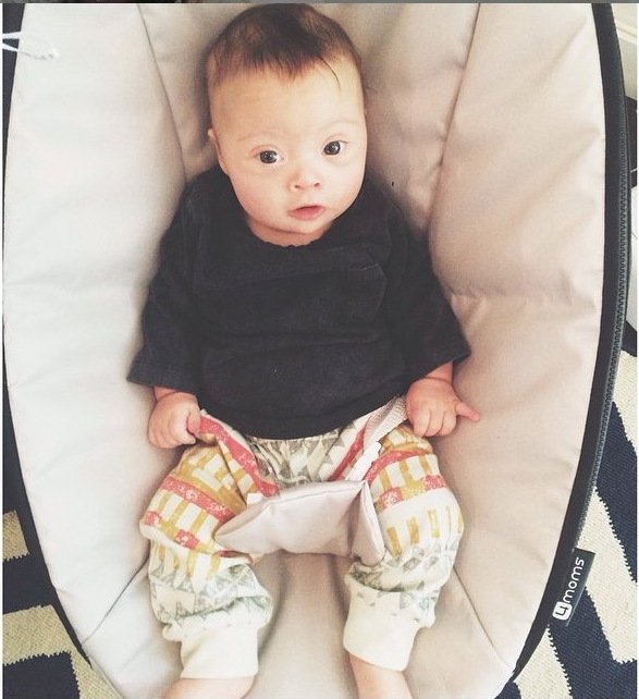 Μπόμπιρας με Σύνδρομο Down κάνει καριέρα στο μόντελινγκ [εικόνες & βίντεο]  | iefimerida.gr 6