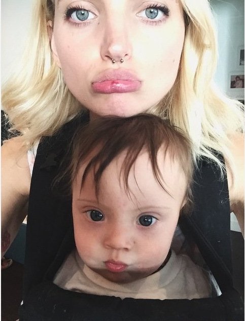 Μπόμπιρας με Σύνδρομο Down κάνει καριέρα στο μόντελινγκ [εικόνες & βίντεο]  | iefimerida.gr 8