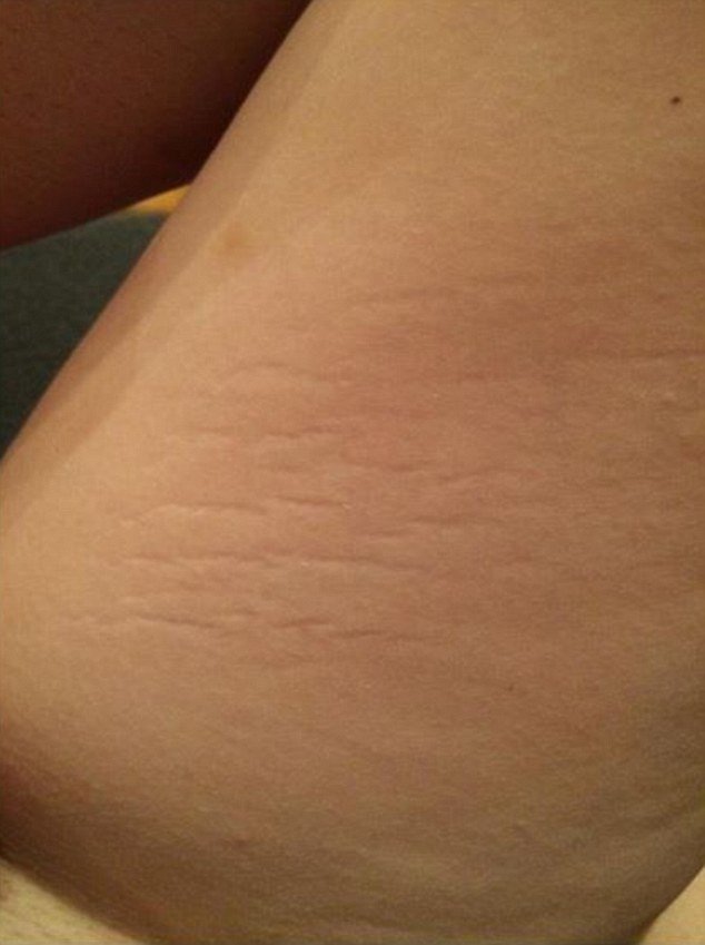 H νέα τρέλα στο Ιντερνετ -Γυναίκες διαβάζουν τις... ραγάδες τους [εικόνες] | iefimerida.gr 0