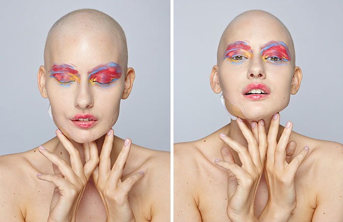 Μοντέλο γύρισε από την κόλαση: Εχασε το σαγόνι της από καρκίνο αλλά επέστρεψε στο μόντελινγκ [εικόνες] | iefimerida.gr 4