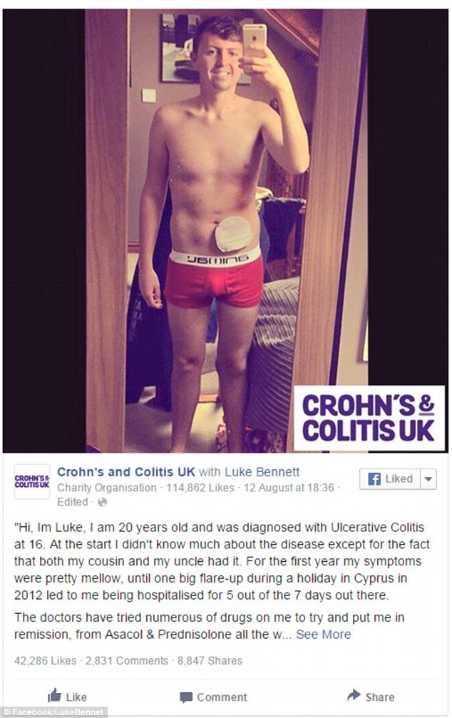 Φοιτητής νομικής φωτογραφίζεται με κολοστομία και συγκλονίζει [εικόνες] | iefimerida.gr 0