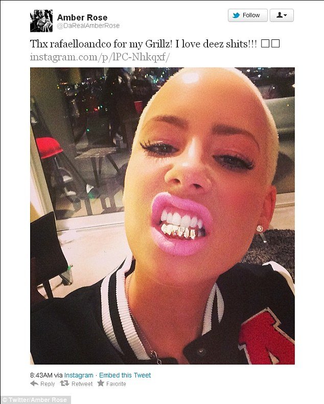 Σιδεράκια στα δόντια –Eγιναν τάση, μόδα, ένδειξη υγείας και πλούτου [εικόνες] | iefimerida.gr 7