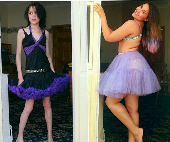 Κατακτά το Instagram: Ξεπέρασε την ανορεξία και ποζάρει γεμάτη αυτοπεποίθηση δείχνοντας τις καμπύλες της [εικόνες] | iefimerida.gr 3