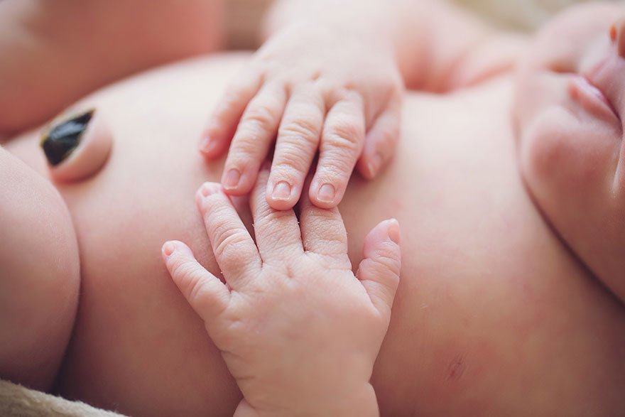 Γονείς φωτογραφίζουν το νεογέννητό τους, με σύνδρομο Down και όγκο στον εγκέφαλο και συγκινούν [εικόνες] | iefimerida.gr 5