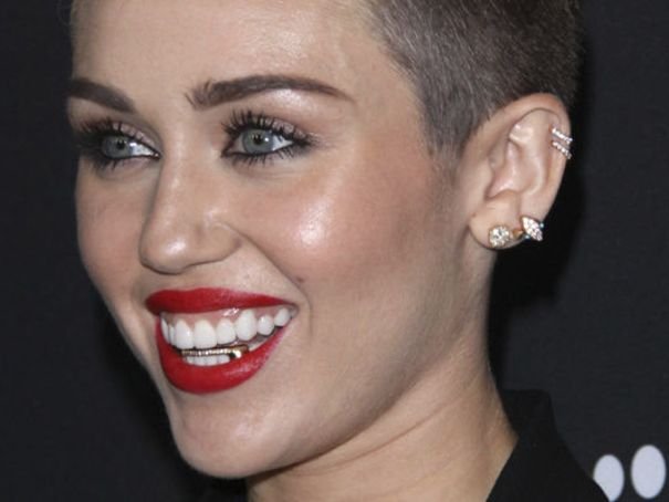 Σιδεράκια στα δόντια –Eγιναν τάση, μόδα, ένδειξη υγείας και πλούτου [εικόνες] | iefimerida.gr 3