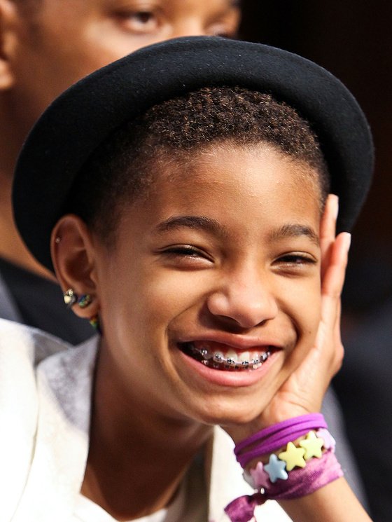 Σιδεράκια στα δόντια –Eγιναν τάση, μόδα, ένδειξη υγείας και πλούτου [εικόνες] | iefimerida.gr 5