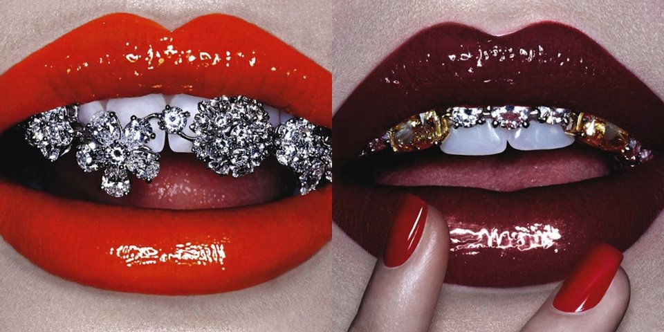 Σιδεράκια στα δόντια –Eγιναν τάση, μόδα, ένδειξη υγείας και πλούτου [εικόνες] | iefimerida.gr 9