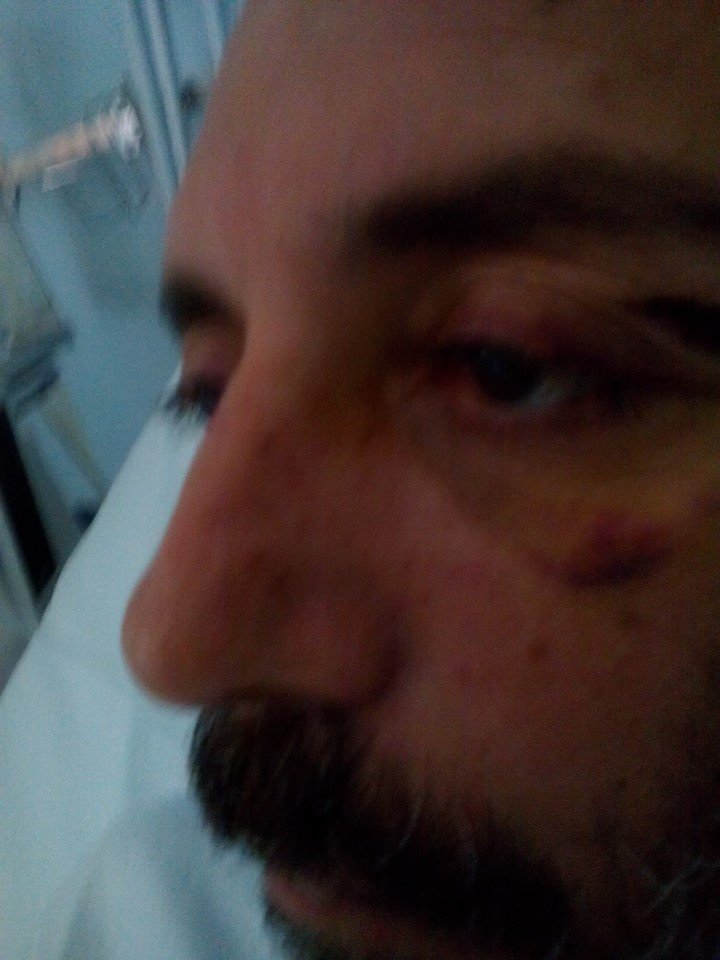 Το σοβαρό τροχαίο δημοσιογράφου του ΣΚΑΪ με τη μηχανή του [εικόνες] | iefimerida.gr 2