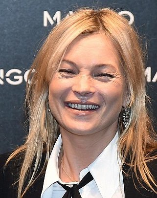 Κέιτ Μος: Πώς το τσιγάρο, τα ξενύχτια και ο ήλιος «έσπασαν» το πρόσωπό της - Καρέ καρέ οι αλλαγές [εικόνες] | iefimerida.gr 1