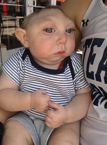 Ο μικρός μαχητής που διέψευσε τους επιστήμονες – Γεννήθηκε χωρίς εγκέφαλο και έγινε ενός έτους [εικόνες] | iefimerida.gr 1