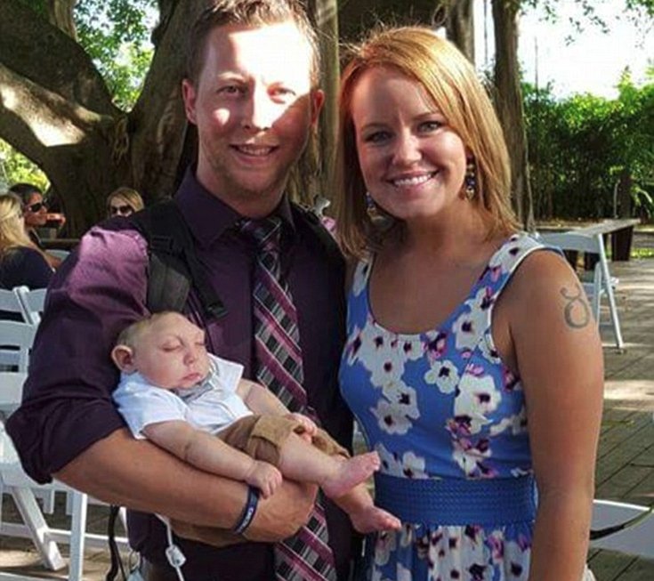 Ο μικρός μαχητής που διέψευσε τους επιστήμονες – Γεννήθηκε χωρίς εγκέφαλο και έγινε ενός έτους [εικόνες] | iefimerida.gr 3