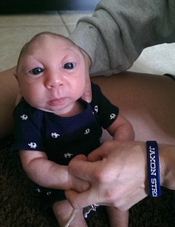 Ο μικρός μαχητής που διέψευσε τους επιστήμονες – Γεννήθηκε χωρίς εγκέφαλο και έγινε ενός έτους [εικόνες] | iefimerida.gr 4