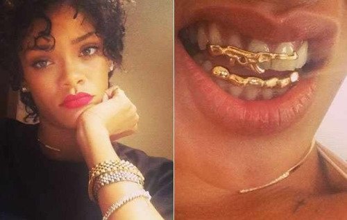 Σιδεράκια στα δόντια –Eγιναν τάση, μόδα, ένδειξη υγείας και πλούτου [εικόνες] | iefimerida.gr 13