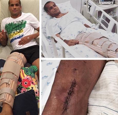 Ο Ριβάλντο στα 43 του στο χειρουργείο [εικονες] | iefimerida.gr 1