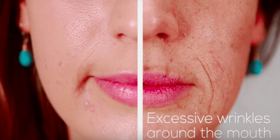 Βίντεο σοκ: Πώς το κάπνισμα αλλάζει και γερνάει το πρόσωπο [εικόνες&βίντεο] | iefimerida.gr 2