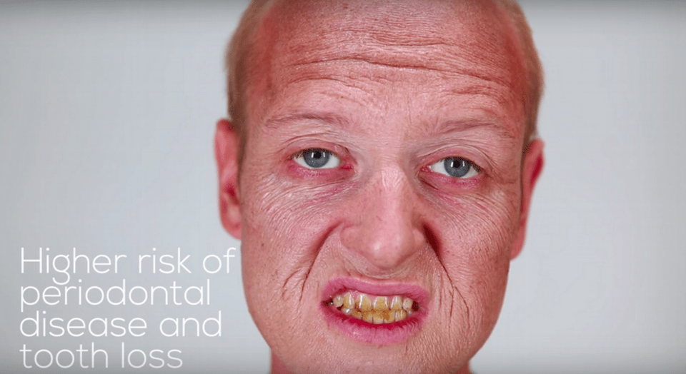 Βίντεο σοκ: Πώς το κάπνισμα αλλάζει και γερνάει το πρόσωπο [εικόνες&βίντεο] | iefimerida.gr 0