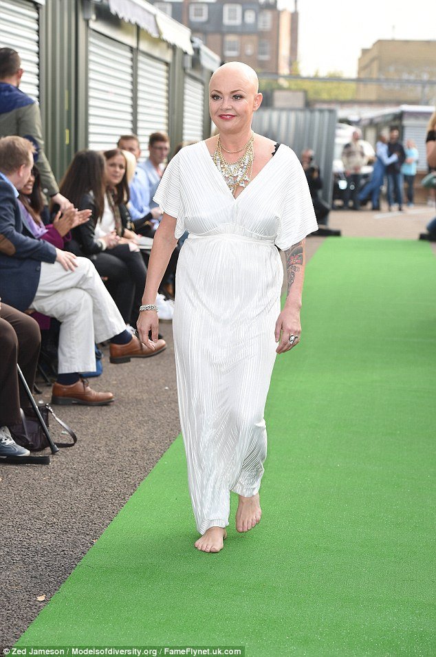 Στην πασαρέλα η χορεύτρια που έχασε το πόδι της στο ατύχημα του Λούνα Παρκ Alton Towers [εικόνες] | iefimerida.gr 3