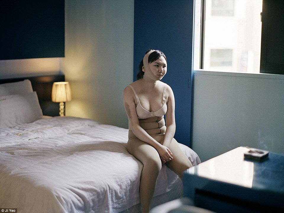 Βασανιστήρια για την ομορφιά -Τα χειρουργεία που κάνουν Κορεάτισσες για να μοιάσουν με Δυτικές [εικόνες] | iefimerida.gr 7