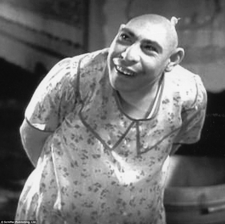 Ανθρωποι που παρουσιάζονταν ως «τέρατα» σε τσίρκο- Εκαναν καριέρα με τις ιδιαιτερότητες τους [εικόνες] | iefimerida.gr 0