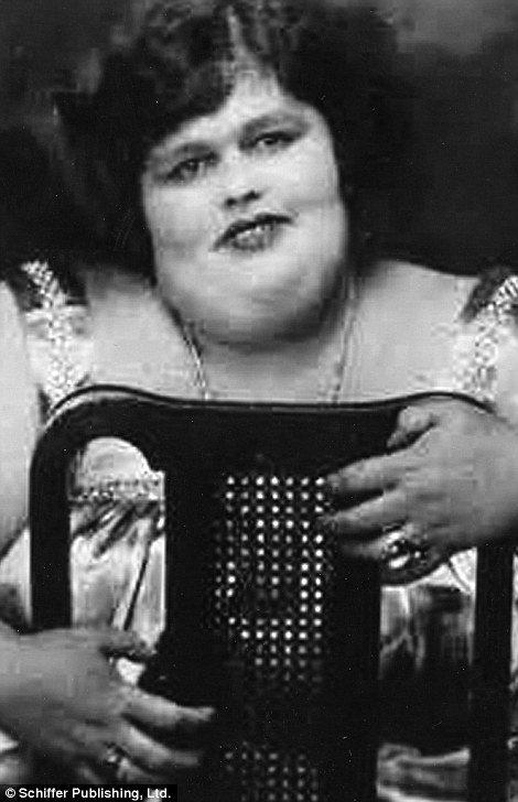 Ανθρωποι που παρουσιάζονταν ως «τέρατα» σε τσίρκο- Εκαναν καριέρα με τις ιδιαιτερότητες τους [εικόνες] | iefimerida.gr 2