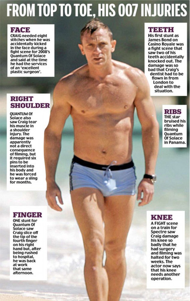 Ολοι οι τραυματισμοί του Ντάνιελ Κρεγκ ως Τζέιμς Μποντ [εικόνες] | iefimerida.gr 3