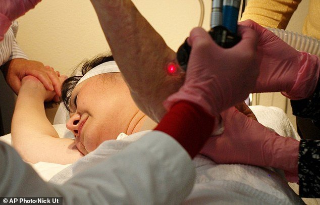 «Το κορίτσι του ναπάλμ»: Απαλλάσσεται από τα σημάδια της ατομικής βόμβας 43 χρόνια μετά [εικόνες]  | iefimerida.gr 3