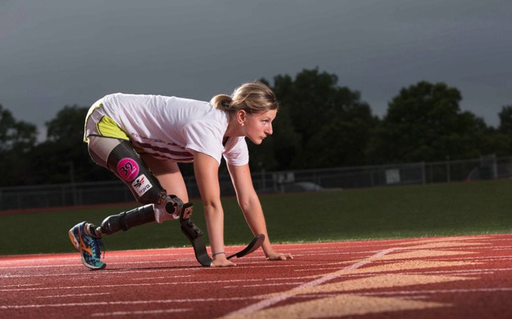 Μια συγκλονιστική γυναίκα: Γεννήθηκε χωρίς πόδια λόγω του Τσερνόμπιλ και έγινε αθλήτρια στίβου [εικόνες]  | iefimerida.gr 2