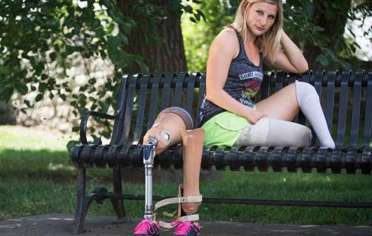 Μια συγκλονιστική γυναίκα: Γεννήθηκε χωρίς πόδια λόγω του Τσερνόμπιλ και έγινε αθλήτρια στίβου [εικόνες]  | iefimerida.gr 3