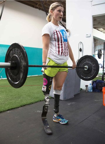 Μια συγκλονιστική γυναίκα: Γεννήθηκε χωρίς πόδια λόγω του Τσερνόμπιλ και έγινε αθλήτρια στίβου [εικόνες]  | iefimerida.gr 5